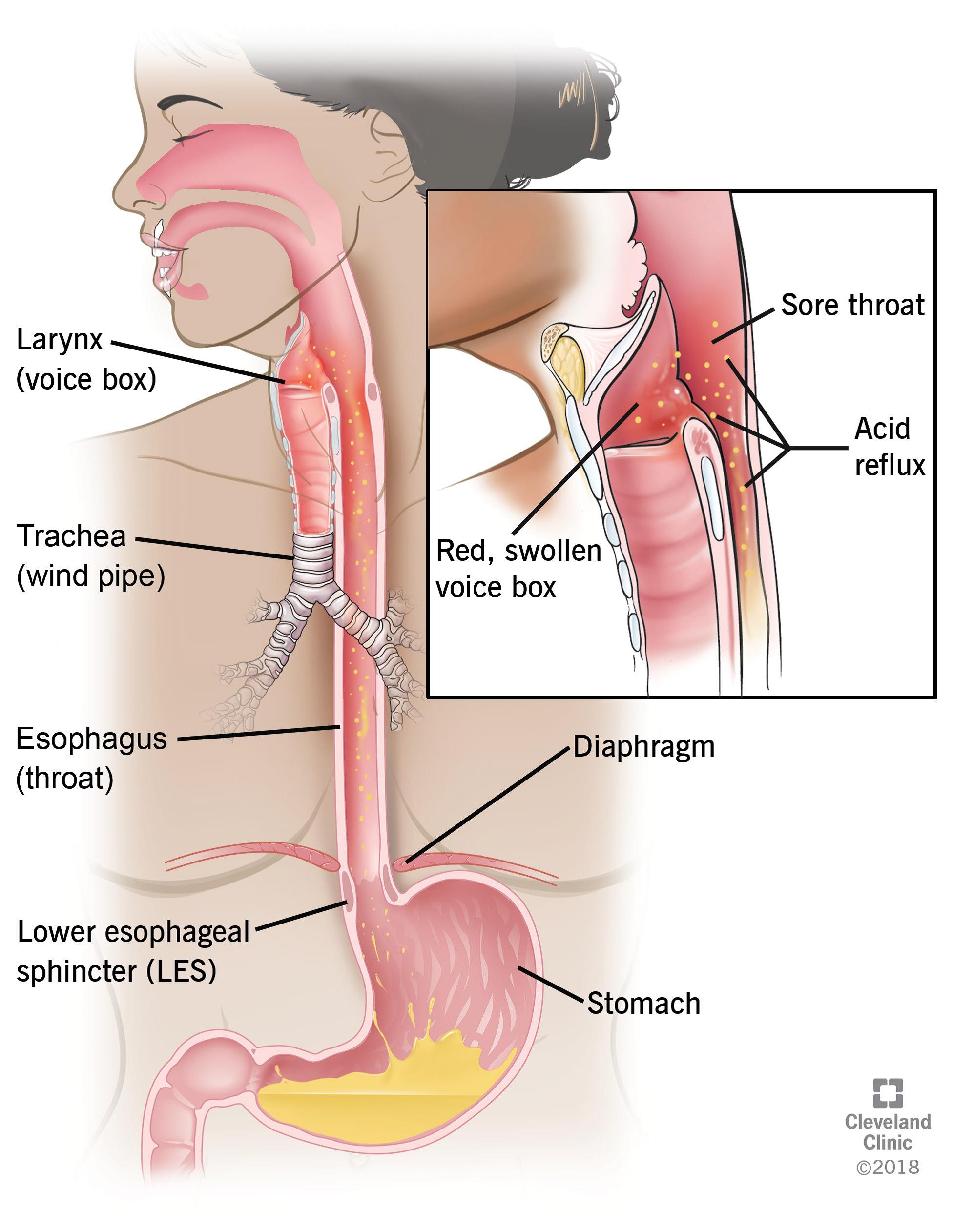 Esophagus   Dr Sanjay Salunkhe